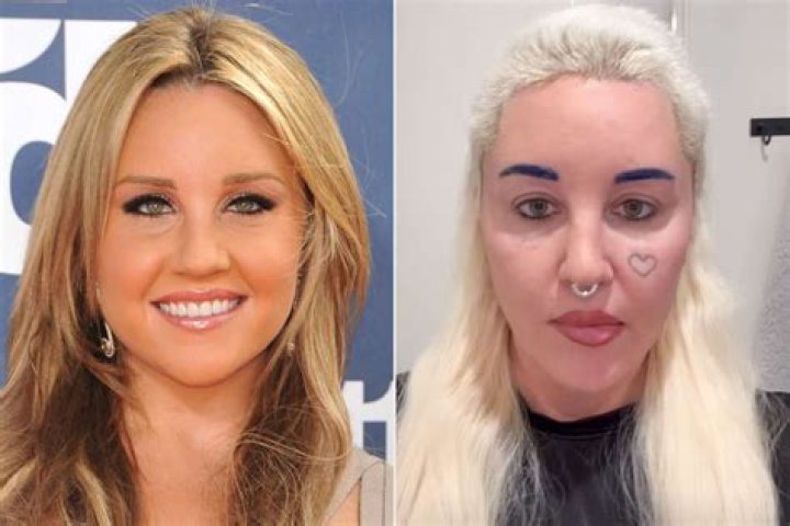Amanda Bynes and Nine Other Stars Addicted to Plastic Surgery