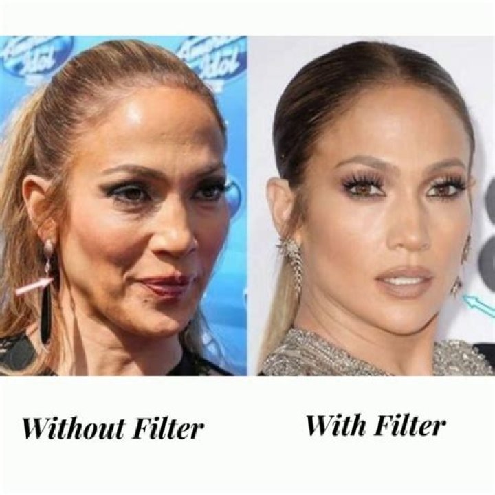 20 Celebrities Who Have Had a Thread Lift