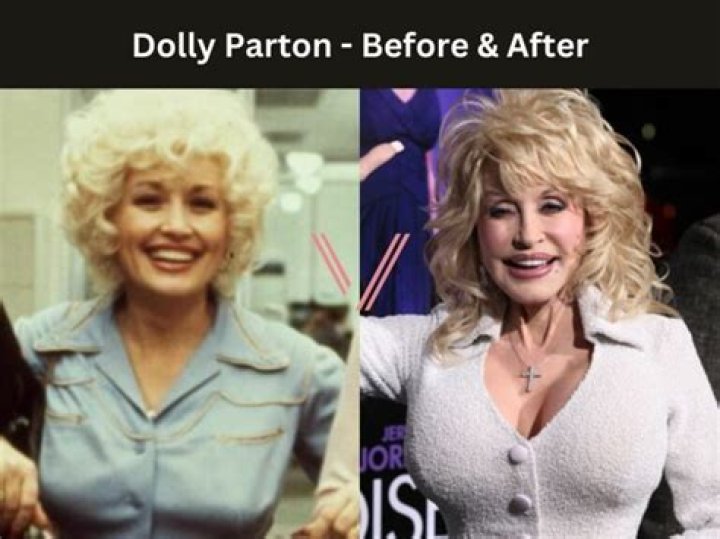 Dolly Parton has committed a huge beauty mistake for 40 years 'for emergencies'